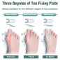 Hallux valgus corrector - ортопедичен коректор за палеца на крака (скоба за пръстите на крака)